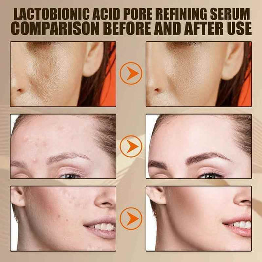 Lactobionic Radiance Pore Refiner Serum