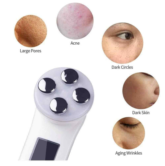 Ems RF Skin Rejuvenator