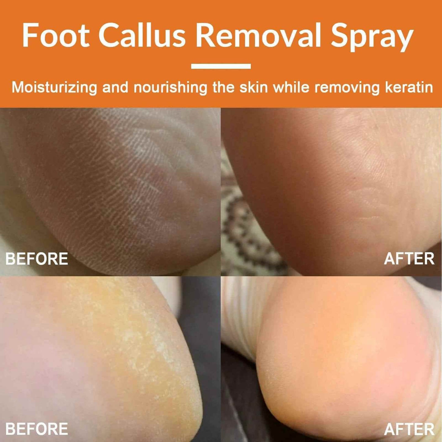 SmoothStride Foot Renewal Spray
