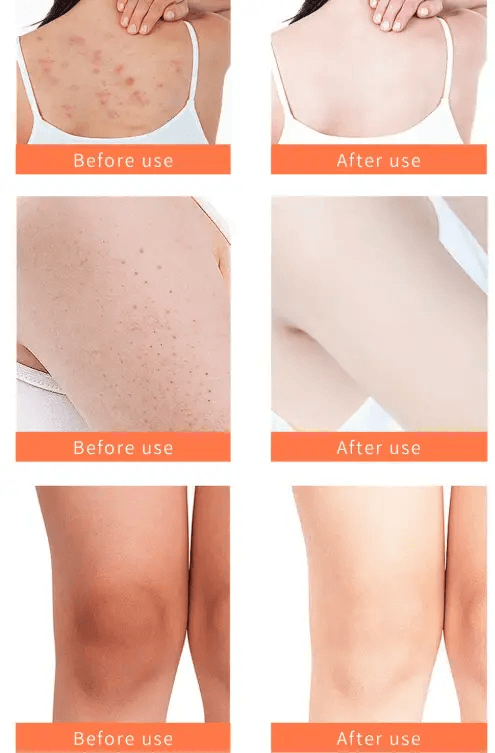 Body Scrub effectiveness shown in before and after use images for skin improvement.