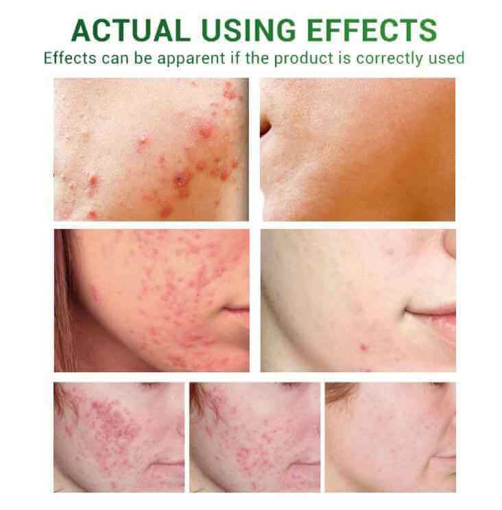 Skin Renewal Face Serum