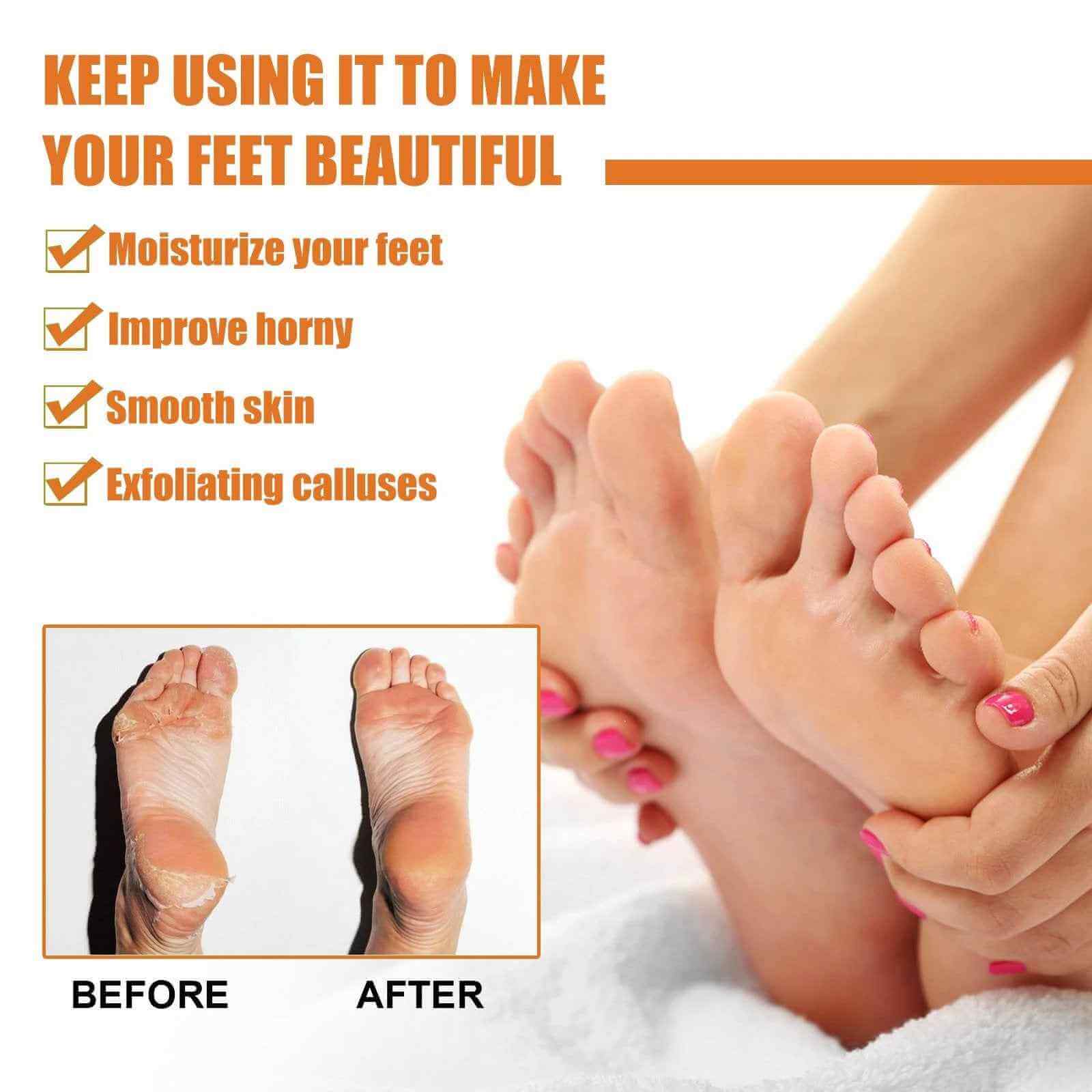 SmoothStride Foot Renewal Spray