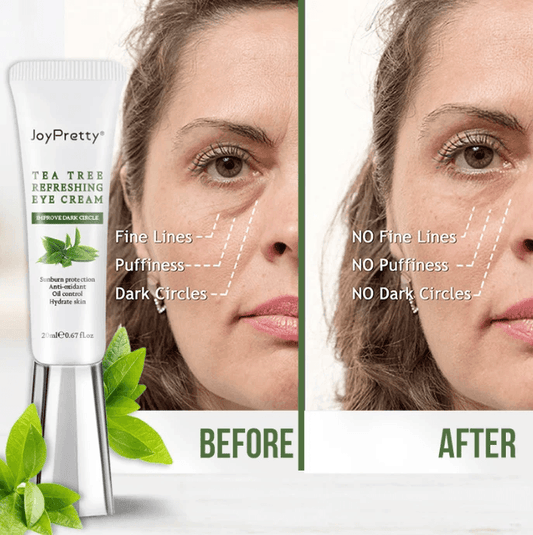 Oil Control Pimple Eraser Facial Cream by Pampering Heaven