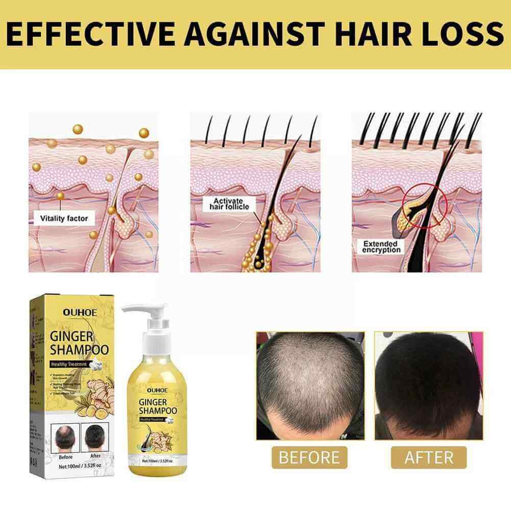 Moisturizing Anti-Itching Firming Hair Care Shampoo