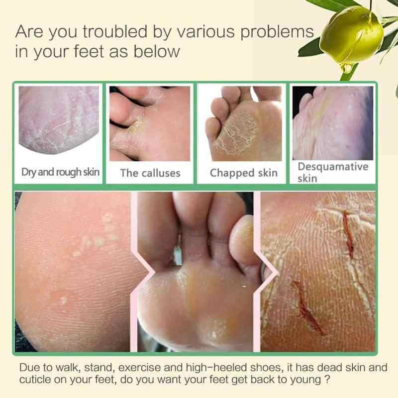 Smooth Feet Exfoliating Mask