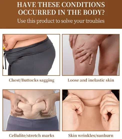 Image showcasing body issues like sagging skin, cellulite, and wrinkles addressed by Body Fever Massage Oil.