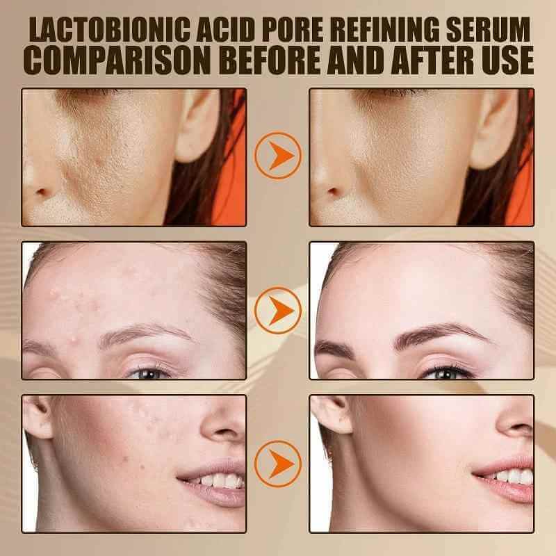 Lactobionic Radiance Pore Refiner Serum