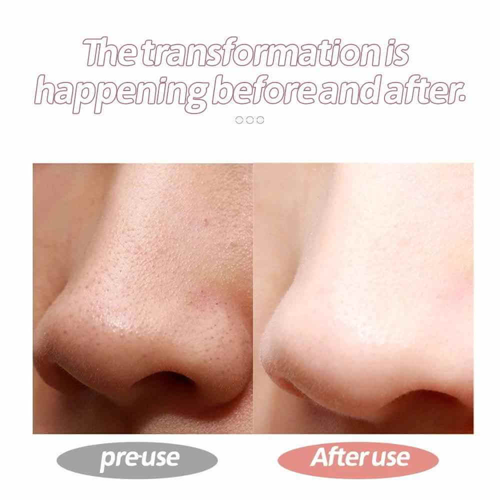 GlowMate Ultrasonic Facial Tool