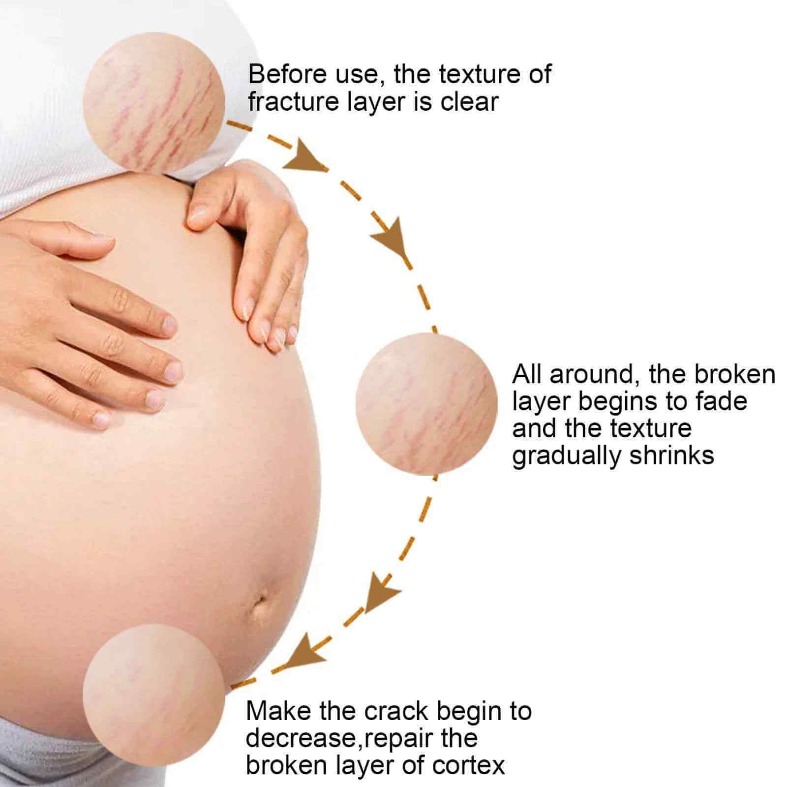 EELHOE Maternal Skincare Cream